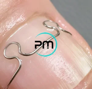 Сложная ортониксия 3 podomama.by