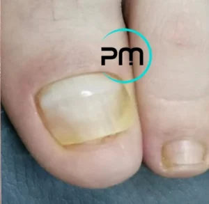 шинирование podomama.by